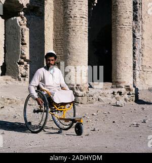 Disability. Double above-the-knee amputee sitting in his wheelchair. This man lost his legs in a land mine explosion. Photographed in Afghanistan wher Stock Photo