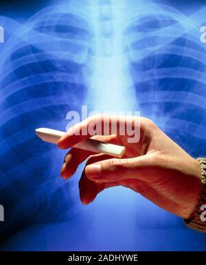 Nicotine inhaler. Hand holds a Nicorette nicotine drug inhaler in front of a healthy chest X-ray. Nicorette inhalers are used by people who want to gi Stock Photo