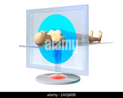 CT scan, conceptual computer artwork. Computed tomography (CT), also known as computed axial tomography (CAT), is a medical imaging technique where an Stock Photo