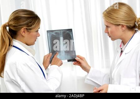MODEL RELEASED. Chest x-ray. Doctors discussing a patient's chest x-ray. Stock Photo