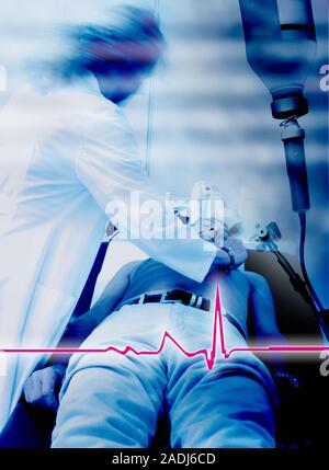 Emergency defibrillation. Doctor using a defibrillator on a patient suffering from a heart attack. An ECG trace of a heart beat is across lower frame. Stock Photo