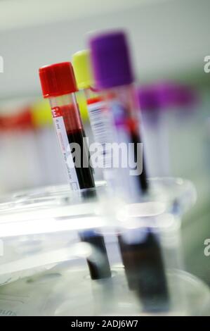 Blood samples in vacutainers. These samples have been routinely collected during blood donation by volunteer donors. The blood will be screened for bl Stock Photo