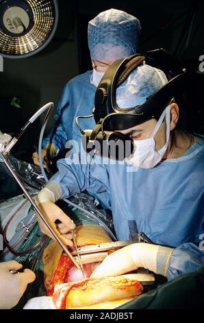 MODEL RELEASED. Surgeon wearing a headmounted display unit during a heart operation. The unit projects 3D images of the heart in real time in front of Stock Photo
