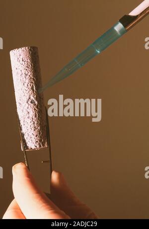 Bioceramic used in bone reconstruction. Technician pipetting a solution of cells onto a segment of bioceramic material. This porous material is made o Stock Photo
