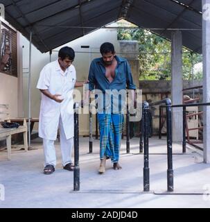 Prosthetic leg. Man being taught to walk with a prosthetic leg. Correct fitting of a prosthesis is essential to help the amputee regain full mobility. Stock Photo