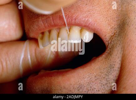 Flossing teeth. Close-up of a man flossing his teeth. He has wrapped the floss (white thread) around his fingers and is running it through the gaps in Stock Photo