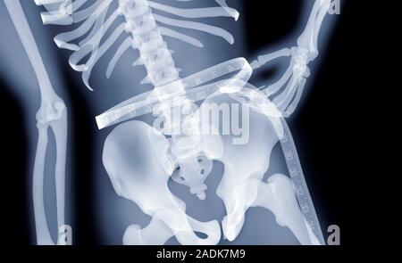 Measuring the waist. Computer artwork based on an x-ray of a person using a tape-measure to measure their waist. Stock Photo