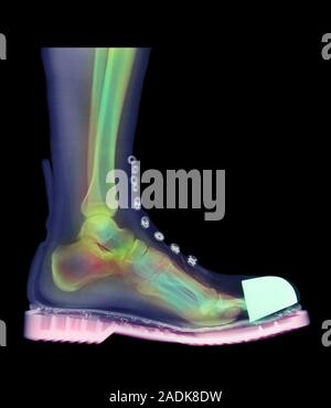 Foot in boot. Coloured X-ray of a man's foot seen in side view, wearing a Doc Marten boot. The boot has a steel cap at the toes. Bones and soft tissue Stock Photo