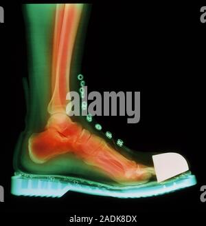 Foot in boot. Coloured X-ray of a man's foot seen in side view, wearing a Doc Marten boot. The boot has a steel cap at the toes. Bones and soft tissue Stock Photo