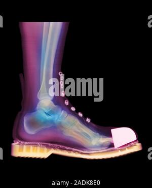 Foot in boot. Coloured X-ray of a man's foot seen in side view, wearing a Doc Marten boot. The boot has a steel cap at the toes. Bones and soft tissue Stock Photo