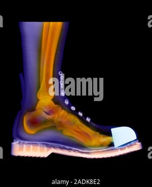 Foot in boot. Coloured X-ray of a man's foot seen in side view, wearing a Doc Marten boot. The boot has a steel cap at the toes. Bones and soft tissue Stock Photo