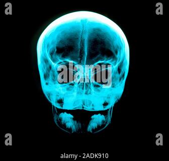 Human skull. X-ray of a human skull, seen from the front. At top is the rounded cranium which houses the brain. Teeth are seen in the upper and lower Stock Photo