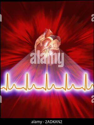 Healthy ECG heart trace. Computer-enhanced image of an electrocardiogram (ECG) trace of the normal heartbeat, with a human heart seen in the back- gro Stock Photo