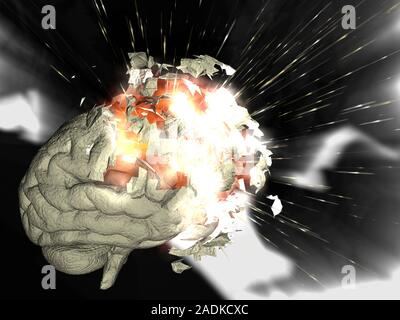 Exploding brain. Conceptual computer artwork of a human brain exploding. This image could represent mental stress or complex thought processes leading Stock Photo