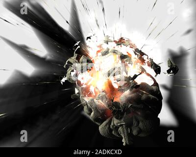 Exploding brain. Conceptual computer artwork of a human brain exploding. This image could represent mental stress or complex thought processes leading Stock Photo
