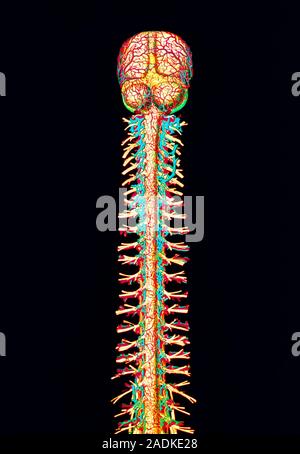 Spinal cord. Computer-enhanced historical illustr- ation of the spinal cord and brain of a human. Both organs are seen without the skeletal structures Stock Photo