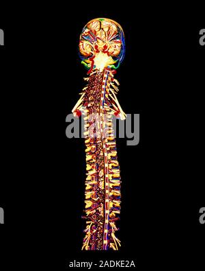 Spine & brain. Computer-enhanced historical art- work of the human spine & brain. The brain is seen at top with it's blue & red cerebral blood vessels Stock Photo