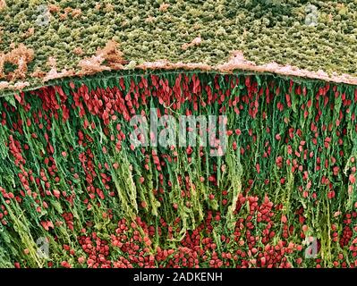Foetal brain cells. Coloured scanning electron micrograph (SEM) of neurons (nerve cells) in the corpus striatum of a foetal brain. Neurons are respons Stock Photo