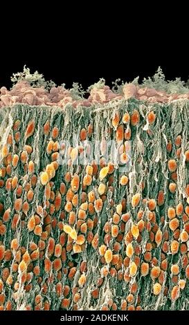 Foetal brain cells. Coloured scanning electron micrograph (SEM) of neurons (nerve cells) in the corpus striatum of a foetal brain. Neurons are respons Stock Photo