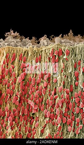 Foetal brain cells. Coloured scanning electron micrograph (SEM) of neurons (nerve cells) in the corpus striatum of a foetal brain. Neurons are respons Stock Photo