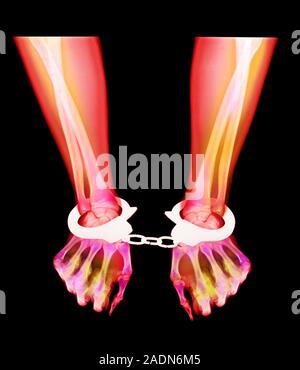 Handcuffed hands. Coloured X-ray of handcuffed hands. Handcuffs are used by police forces as a device for restraining people, especially when they may Stock Photo
