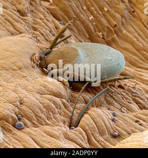Tick feeding on human blood. Coloured scanning electron micrograph (SEM) of a tick (Ixodes sp. )with its mouthparts buried in the skin of its human ho Stock Photo