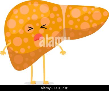 Sick unhealthy cartoon liver character suffers from jaundice or hepatitis and suffering pain. Human exocrine gland organ destruction concept. Vector hepatic illustration Stock Vector