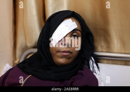 Gaza City, Gaza Strip, Palestinian Territory. 7th Dec, 2019. Palestinian girl Mai Abu Ruwaida, 23, who lost her eye by Israeli troops during clashes at Gaza-Israel border, lies on bed at a hospital, in Gaza city on December 7, 2019 Credit: Ashraf Amra/APA Images/ZUMA Wire/Alamy Live News Stock Photo