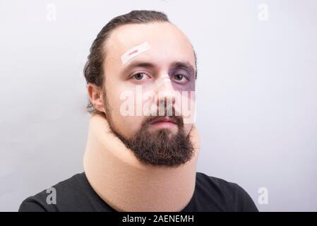 Closeup portrait of a young guy with bruises on his face, with a neck injury. The collar is placed in the neck to immobilize the cervical vertebrae. D Stock Photo