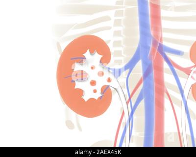 3D anatomical and line illustration of the inside of the kidney, with kidney stones, on a graphic background of the human body. Stock Photo