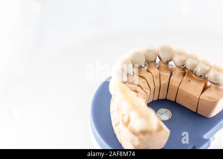 Cose up studio shot of dental imprint with artificial teeth on a dental laboratory workbench. Artificial teeth modeling concept Stock Photo
