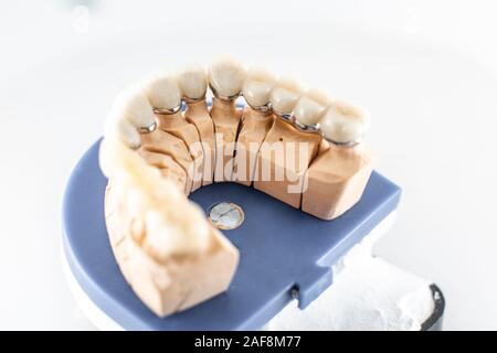 Cose up studio shot of dental imprint with artificial teeth on a dental laboratory workbench. Artificial teeth modeling concept Stock Photo