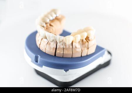 Cose up studio shot of dental imprint with artificial teeth on a dental laboratory workbench. Artificial teeth modeling concept Stock Photo