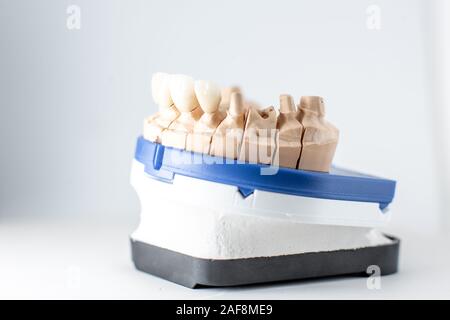 Cose up studio shot of dental imprint with artificial teeth on a dental laboratory workbench. Artificial teeth modeling concept Stock Photo