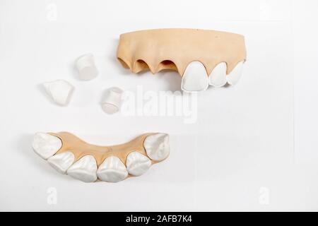 Close-up on a plaster models of jaw fragment with teeth on the white background Stock Photo