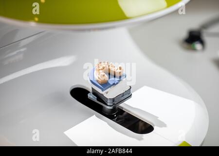 Scanning jaw model on the 3rd scanner in the laboratory, for the manufacture of dentures or implants, close-up Stock Photo