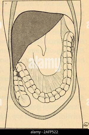 . Anatomie médico-chirurgicale de l'abdomen. B Stock Photo