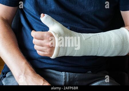 Man with plaster cast on broken hand, broken thumb,broken wrist Stock Photo