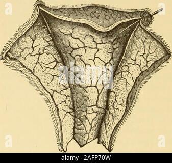 . Clinical gyncology, medical and surgical. Two sutures tied. Fig. 25 ...