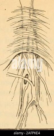 . Anatomie médico-chirurgicale de l'abdomen. f*&lt;s*/ï. Fig. 14 à 16. — Le fascia ombilicalis (daprès Sachs). Stock Photo