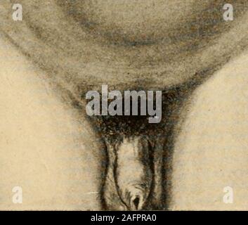 . Anatomie médico-chirurgicale de l'abdomen. Stock Photo