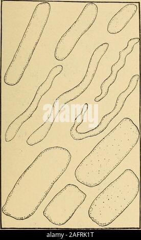 . Urinary analysis and diagnosis by microscopical and chemical examination. generalconstitution of the patient, which, as previously explained, can be posi-tively recognized by the appearance of the pus-corpuscles, need hardlybe mentioned again. A careful examination of all the pus-corpusclespresent in a given case will invariably show how much the constitutionhas been impaired by disease; the paler the pus-corpuscles the more un-favorable the prognosis, and, therefore, the worse the constitution of thepatient at the time of examination. 1. Hyaline Casts (see Fig. 65).—Hyaline casts are pale, Stock Photo