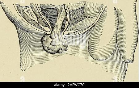 Semiz xoroz video bilan Deepthroat Pornografik hotties fotosuratlari