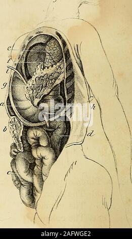 . The anatomy and surgical treatment of abdominal hernia. Fcq.3.. Stock Photo