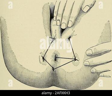 Qizning kokragidan opish video