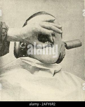 . The science and practice of dental surgery. Fig. SSI. 646. Fig. 882. Stock Photo