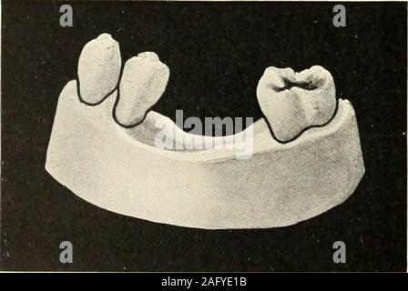 . The science and practice of dental surgery. 853.—Case 3. Fig. 854.—Case 4. 635 Stock Photo