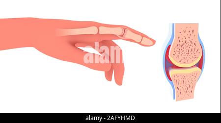 3d illustration of synovial joint. Next to the graphic representation of a hand placing the joint. Stock Photo