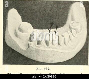Teeth Contacts