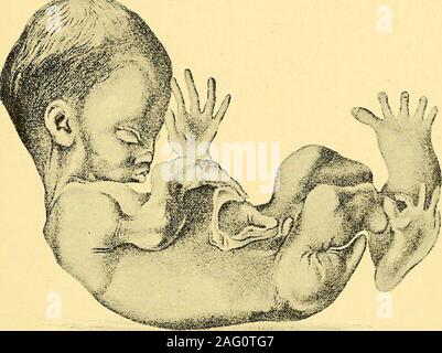 . Manual of antenatal pathology and hygiene : the foetus Stock Photo ...